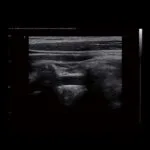 ⁦جهاز سونار ترولي CBit 9⁩ - الصورة ⁦16⁩
