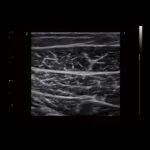 ⁦جهاز سونار ترولي CBit 9⁩ - الصورة ⁦18⁩