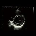 ⁦جهاز سونار ترولي CBit 9⁩ - الصورة ⁦19⁩