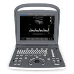 Portable ultrasound system  ECO2 -جهاز سونار محمول