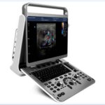 Portable ultrasound system  EBit 30-جهاز سونار محمول