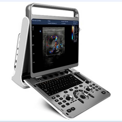 30.jpg Portable ultrasound system EBit 30-جهاز سونار محمول - Image 1
