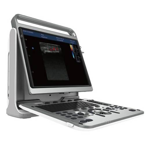 5-1.jpg Portable ultrasound system EBit 50-جهاز سونار محمول - Image 1