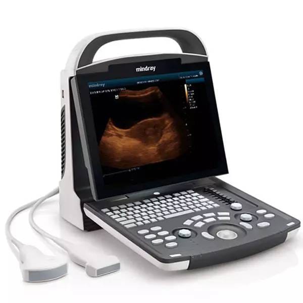 Mindray-DP-15-1.jpg Portable Ultrasound Device DP 15 - جهاز سونار ديجيتال - Image 1