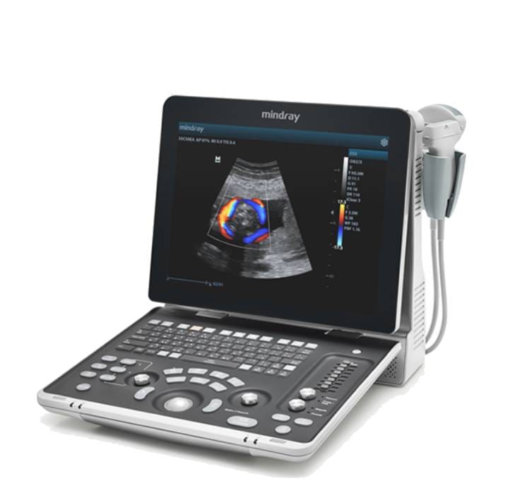 glp113-s1-web.jpg Diagnostic Ultrasound System-Z50 - جهاز سونار ديجيتال - Image 1