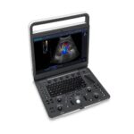 Color Doppler Portable Ultrasound E2 Pro-جهاز سونار دوبلر ملون