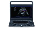 Color Doppler Portable Ultrasound S2-جهاز سونار دوبلر ملون - Image 2