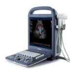 Color Doppler Portable Ultrasound S2-جهاز سونار دوبلر ملون