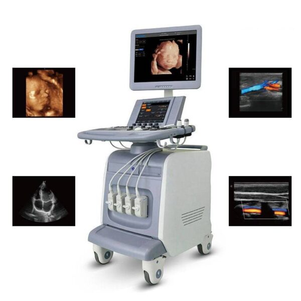 Trolley Color Doppler Ultrasound i6-جهاز سونار دوبلر ملون ترولي - Image 2