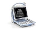 Portable Full Digital Ultrasound DP-20-جهاز سونار ديجيتال - Image 3