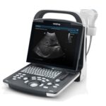Portable Full Digital Ultrasound DP-20-جهاز سونار ديجيتال