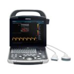 Portable Full Digital Ultrasound DP-30-جهاز سونار ديجيتال