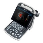 Portable Full Digital Ultrasound DP-30-جهاز سونار ديجيتال - Image 3
