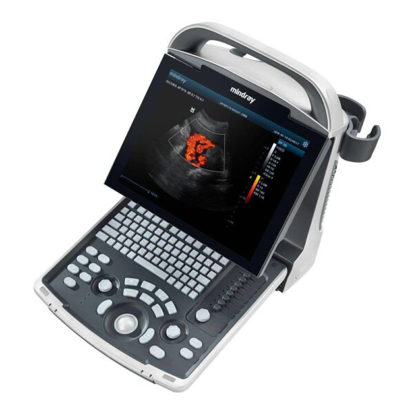 Portable Full Digital Ultrasound DP-30-جهاز سونار ديجيتال - Image 3
