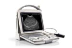 Portable Full Digital Ultrasound DP-30-جهاز سونار ديجيتال - Image 2