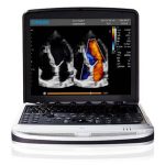 جهاز سونار محمول SonoBook 9