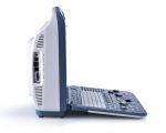 Color Doppler Portable Ultrasound S2-جهاز سونار دوبلر ملون - Image 3