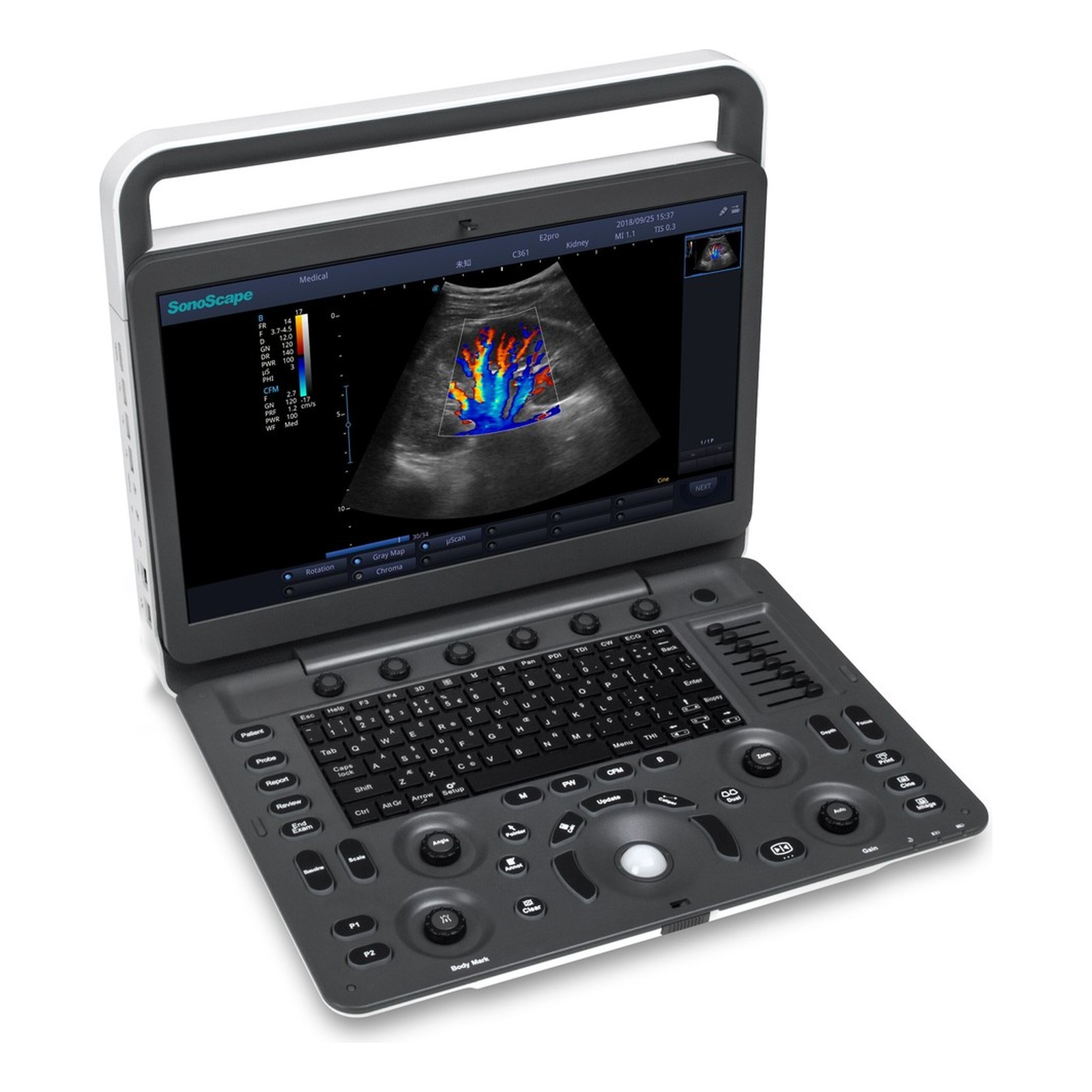 color-doppler-portable-ultrasound-e2-pro-hd جهاز سونار دوبلر ملون محمول SonoScape E2 Pro