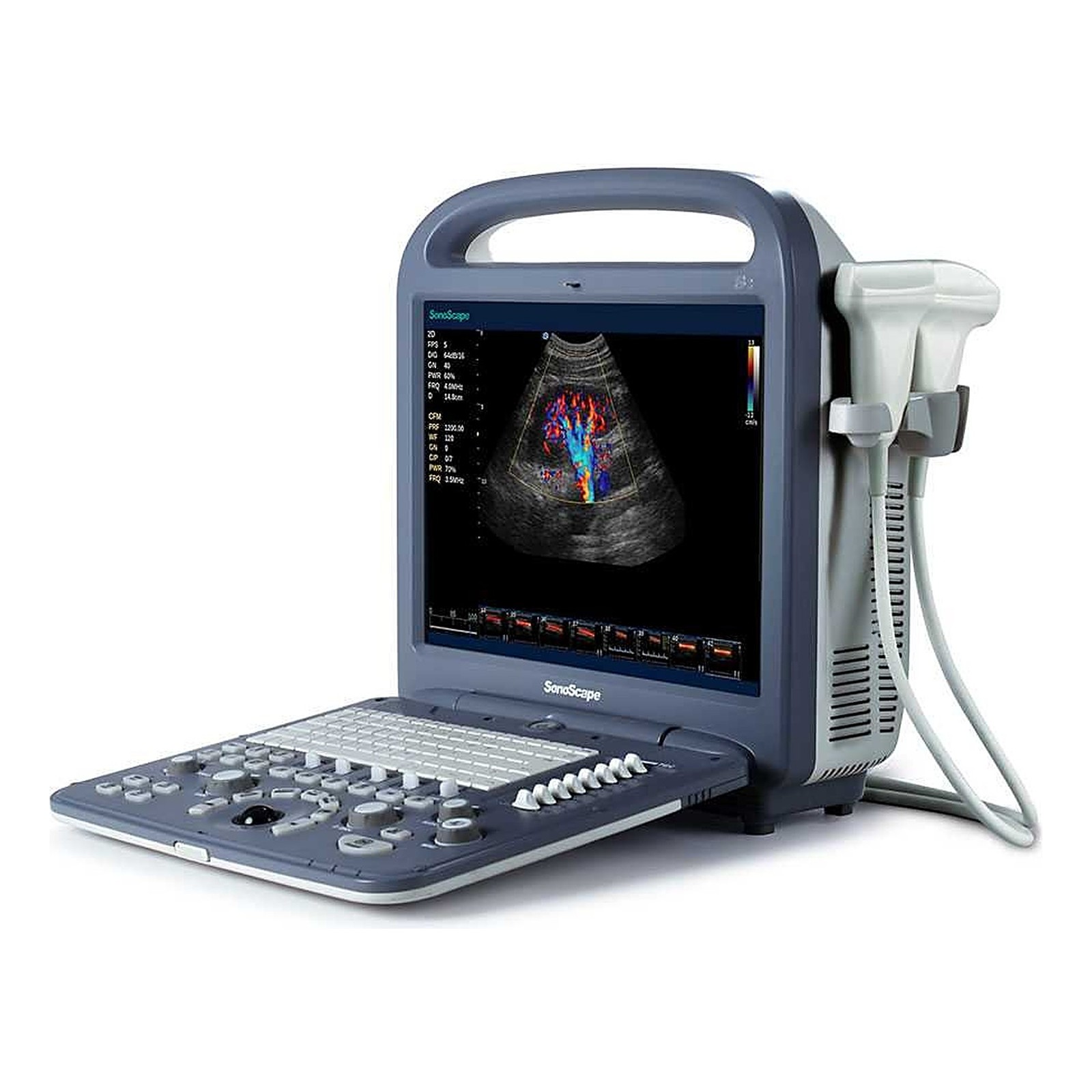 color-doppler-ultrasound-s2-hd جهاز سونار دوبلر ملون محمول SonoScape S2
