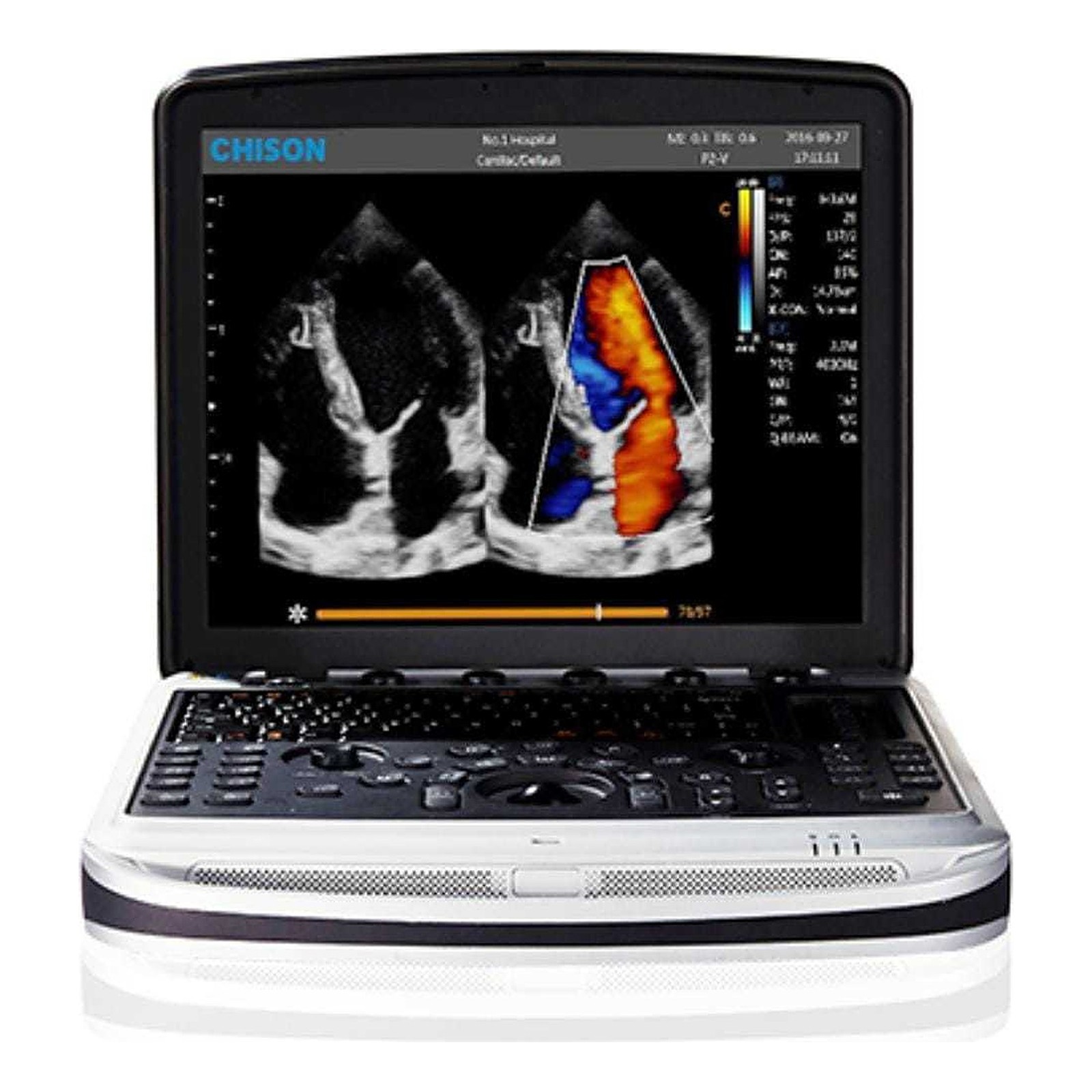 ultrasound-sonobook9-hd جهاز سونار محمول لابتوب Chison SonoBook 9